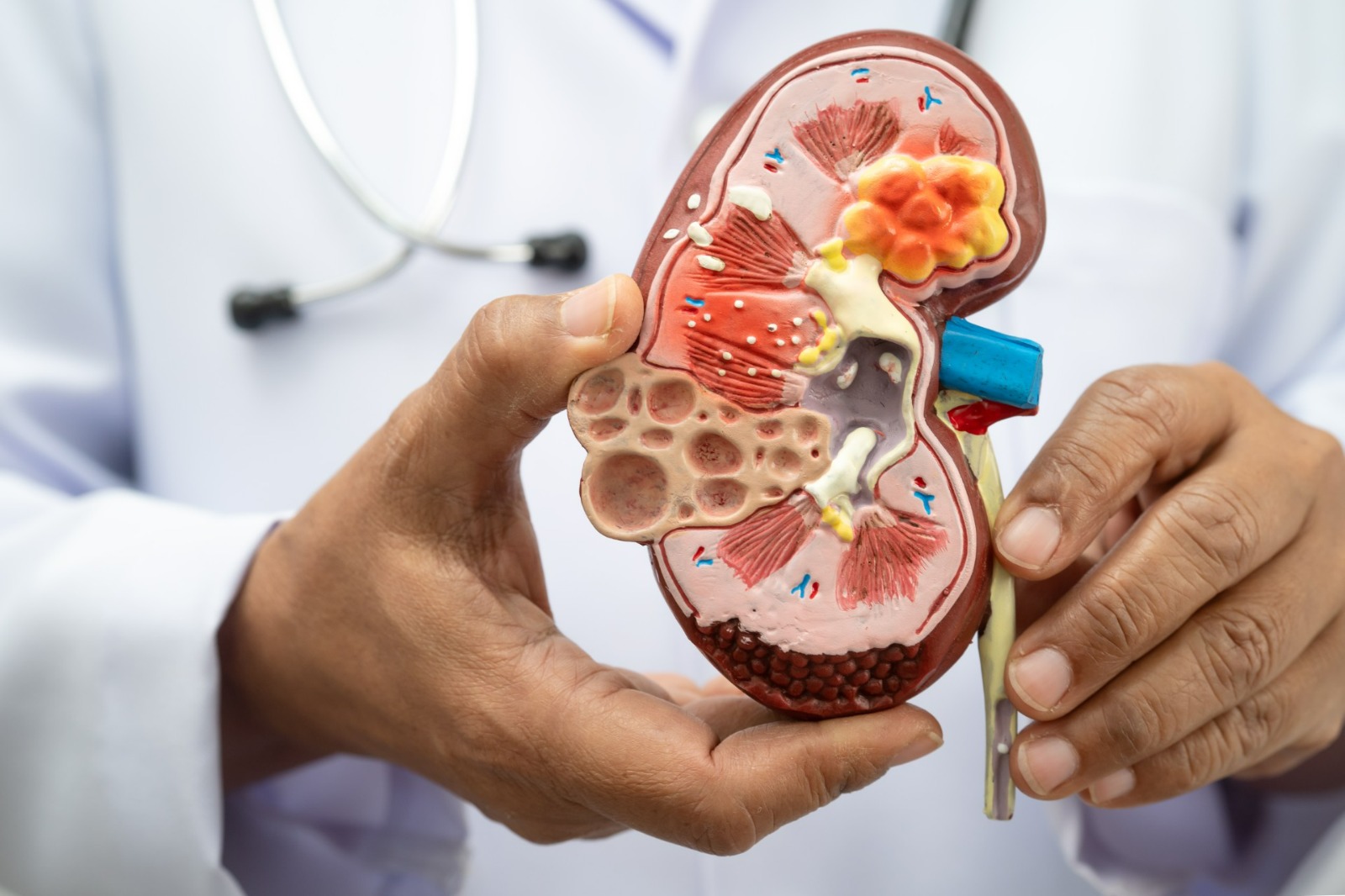 Nefróloga de Cleveland Clinic: Chequeos médicos son claves para proteger salud renal